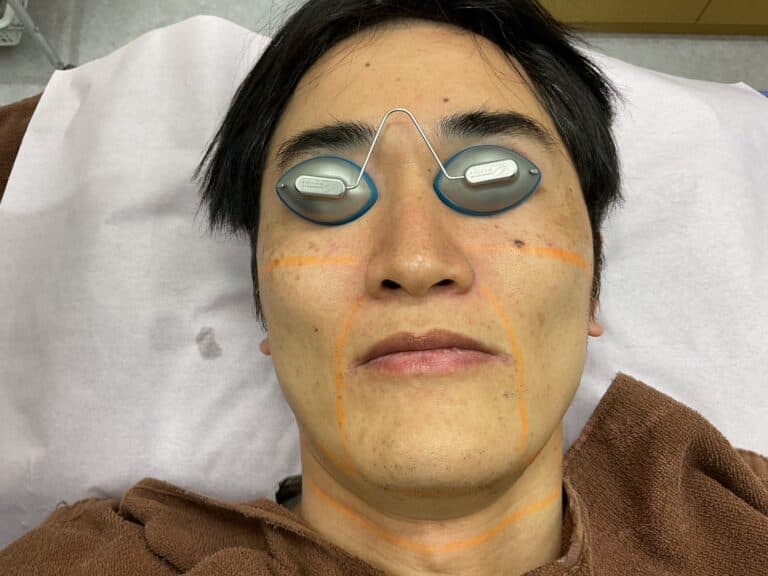 ⑥ゴーグルで目を保護